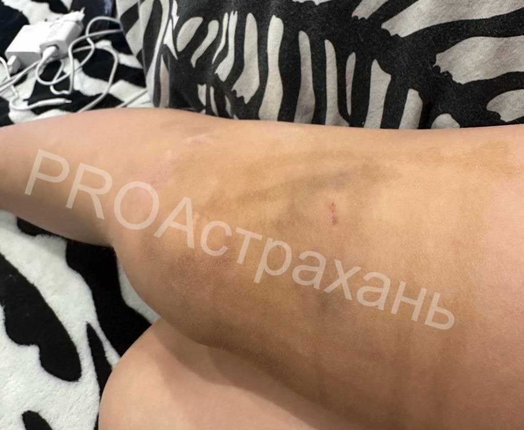 В Астрахани собаки продолжают нападать на школьников