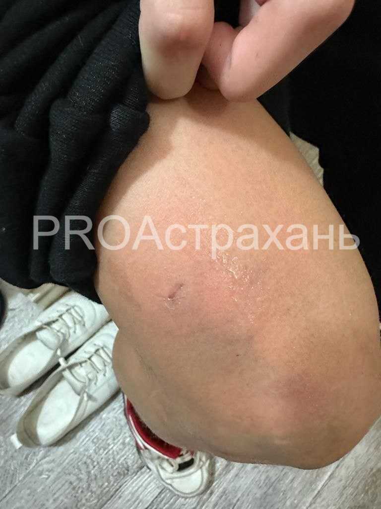 В Астрахани собаки продолжают нападать на школьников — фото 1