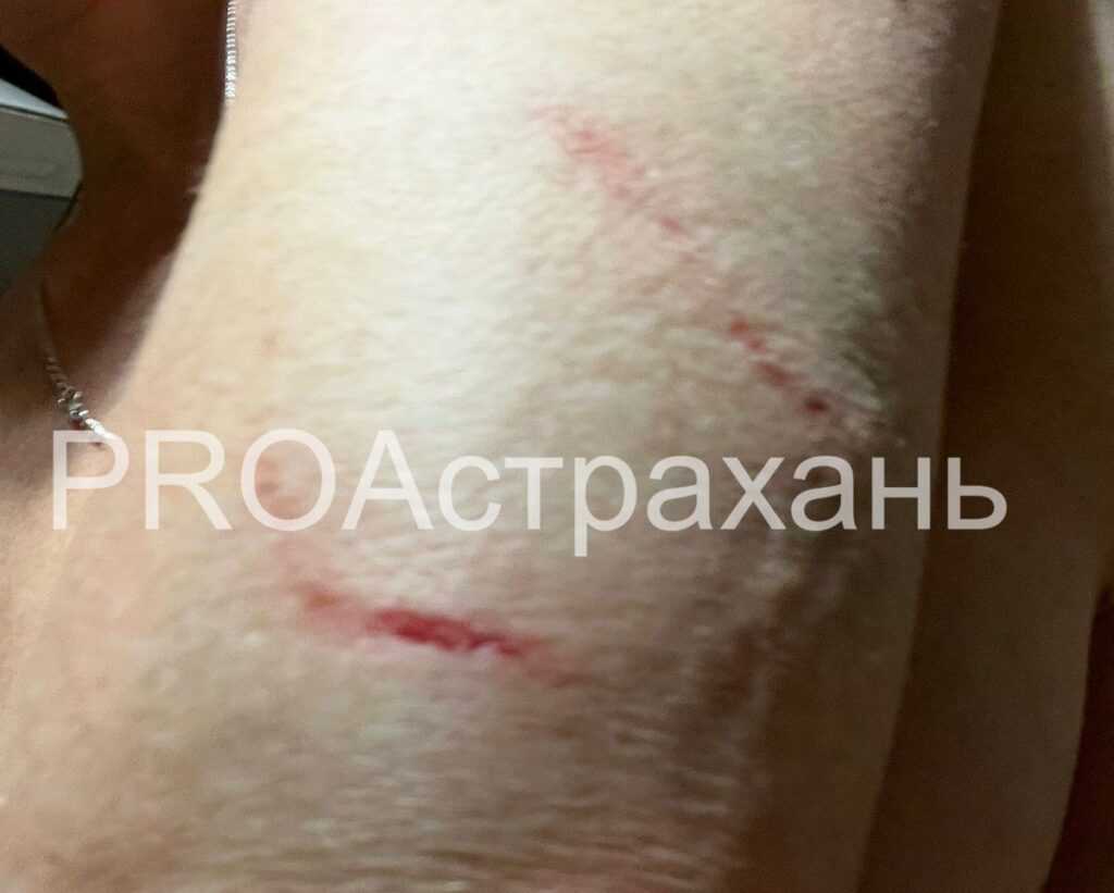 В Астрахани собаки вновь начали активно нападать на людей