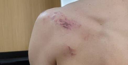 Десять на троих: в селе под Астраханью случилась массовая драка — фото 3