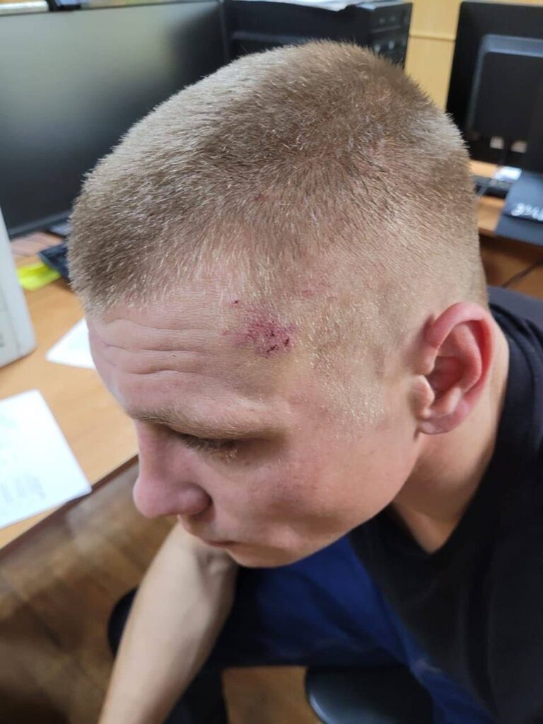 Десять на троих: в селе под Астраханью случилась массовая драка — фото 2
